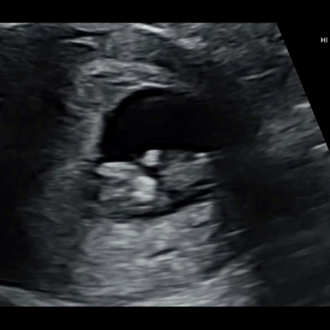 Photo shared by McKenzi for their Babylist baby registry.