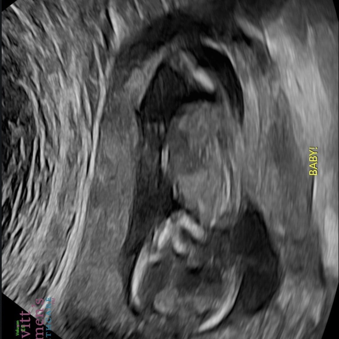 Photo shared by Morgan for their Babylist baby registry.