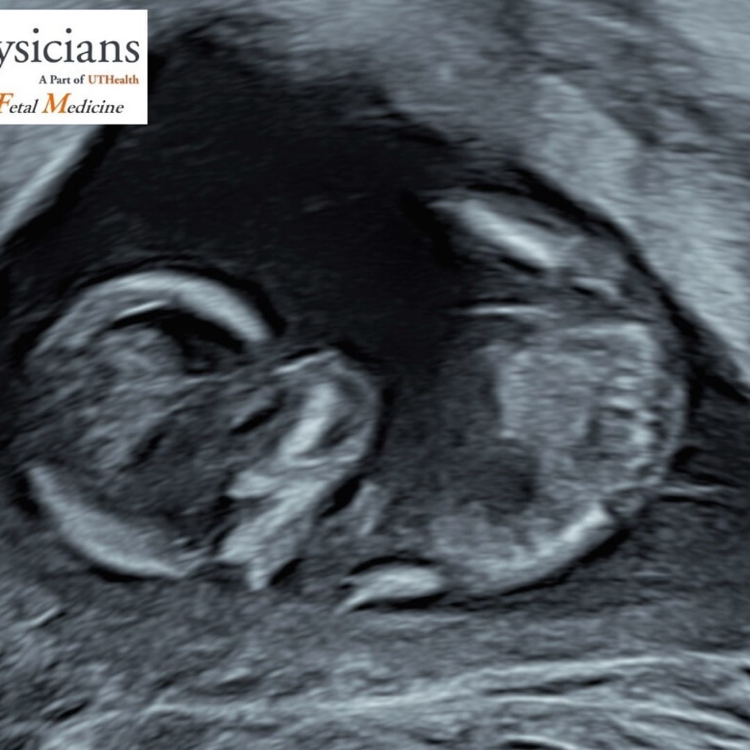 Photo shared by Natalie for their Babylist baby registry.