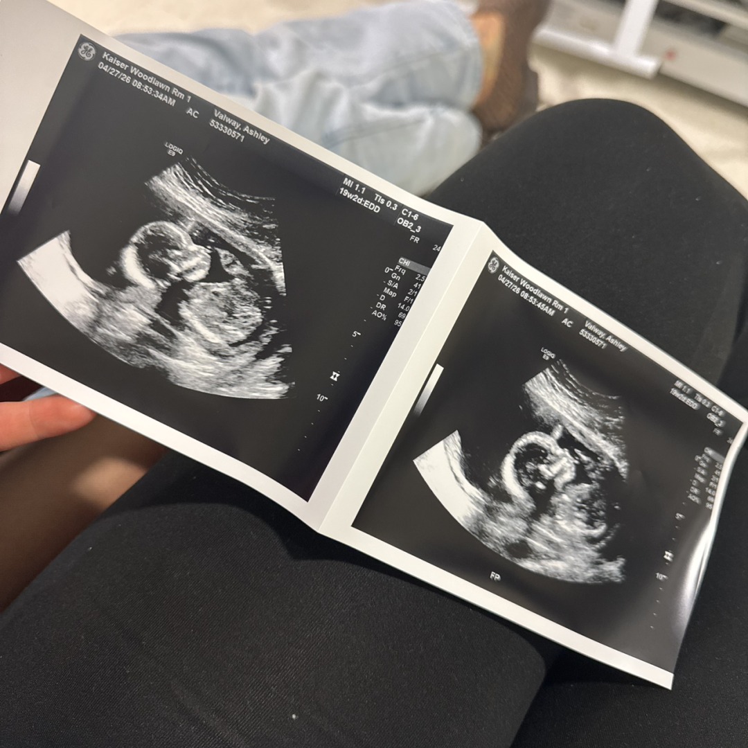 Photo shared by Ashley for their Babylist baby registry.