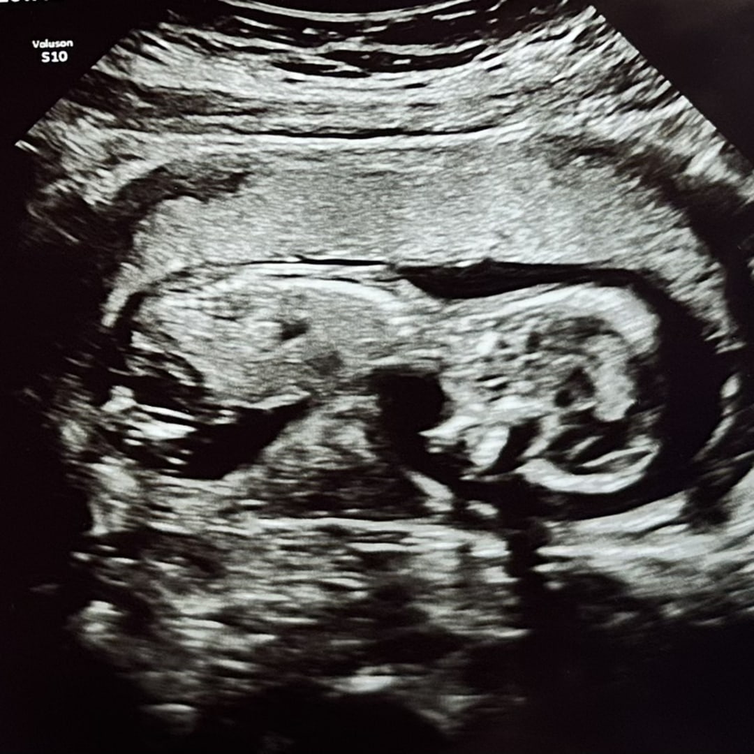 Photo shared by Katlyn for their Babylist baby registry.