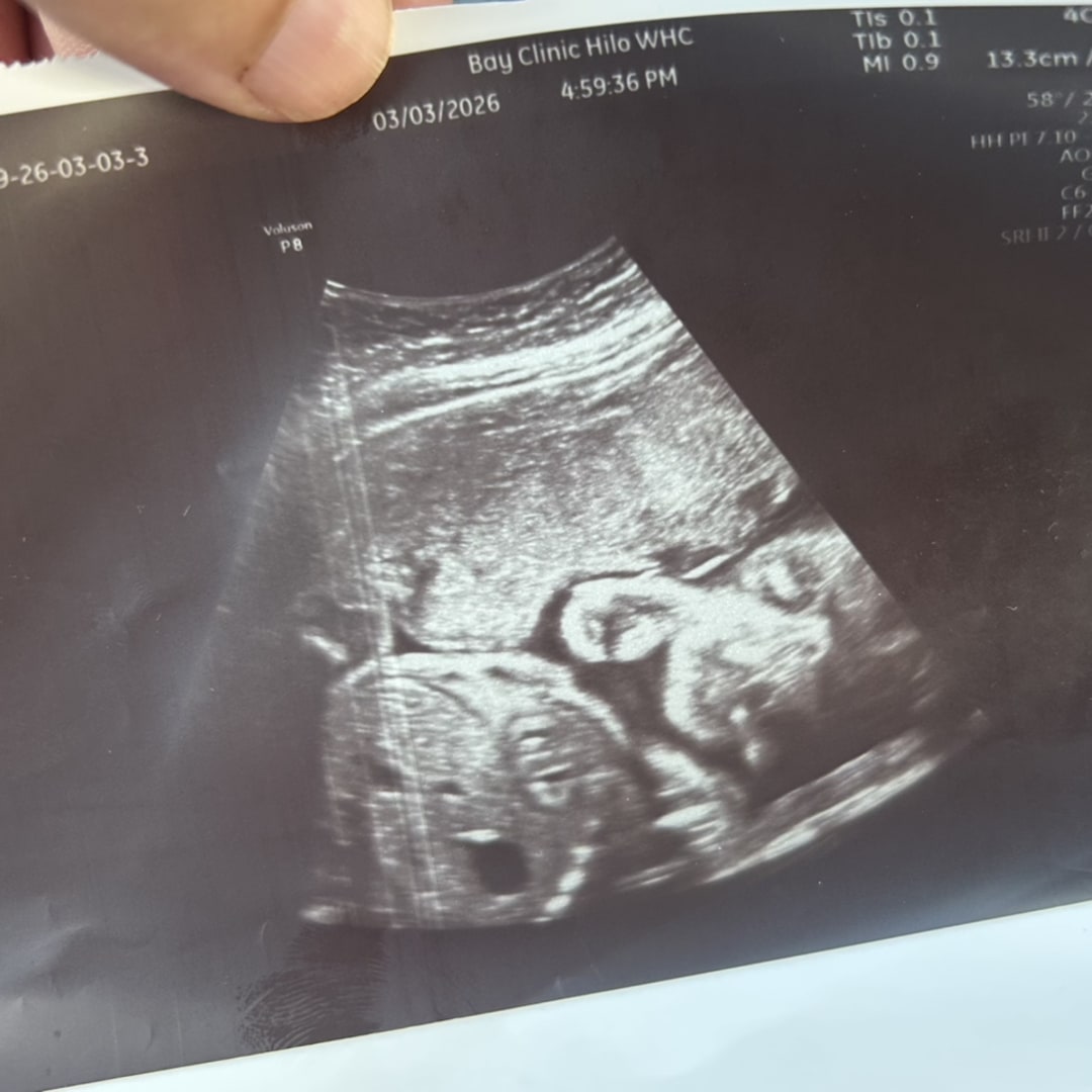 Photo shared by Saige for their Babylist baby registry.