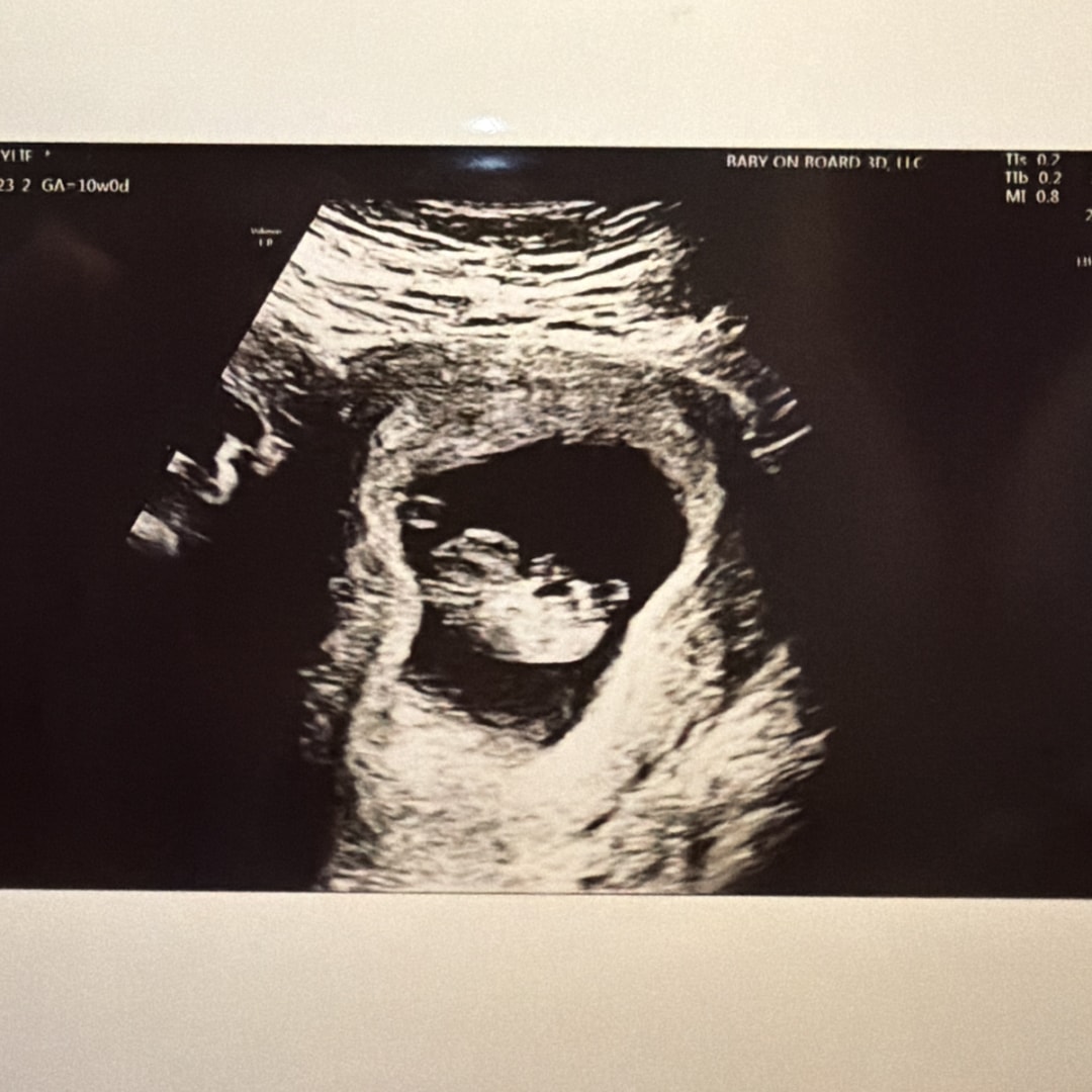 Photo shared by Haylie for their Babylist baby registry.