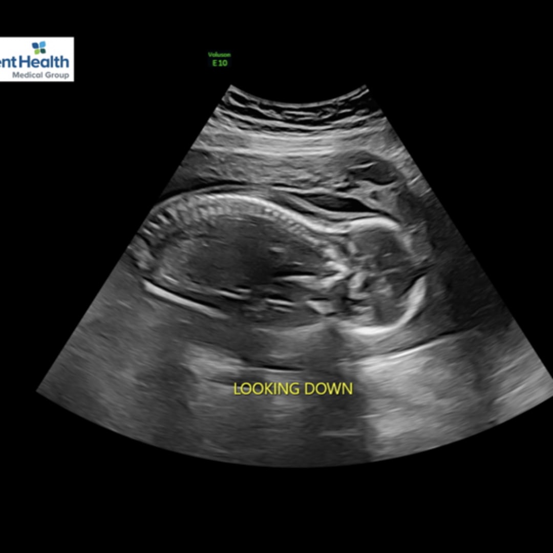 Photo shared by Hannah for their Babylist baby registry.