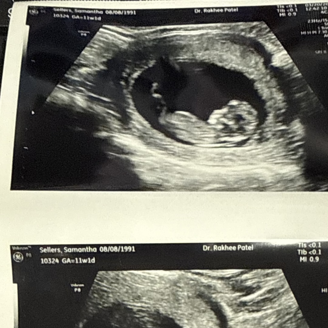 Photo shared by Samantha for their Babylist baby registry.