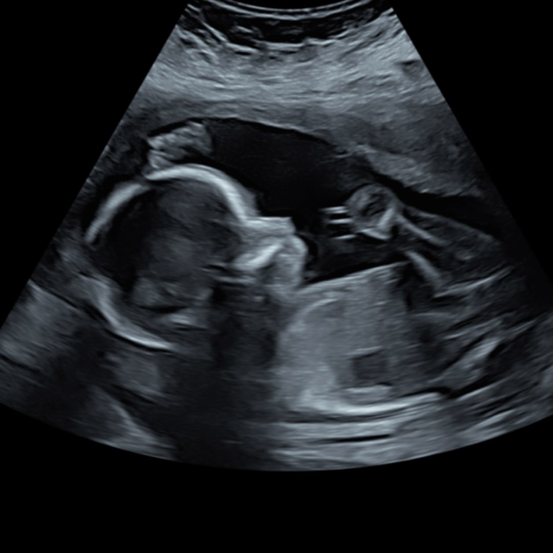 Photo shared by Delia for their Babylist baby registry.