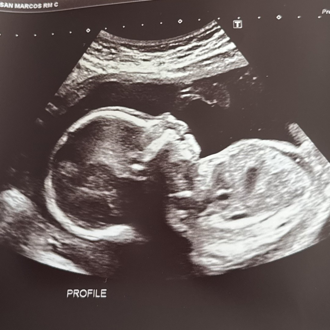 Photo shared by Fiona for their Babylist baby registry.