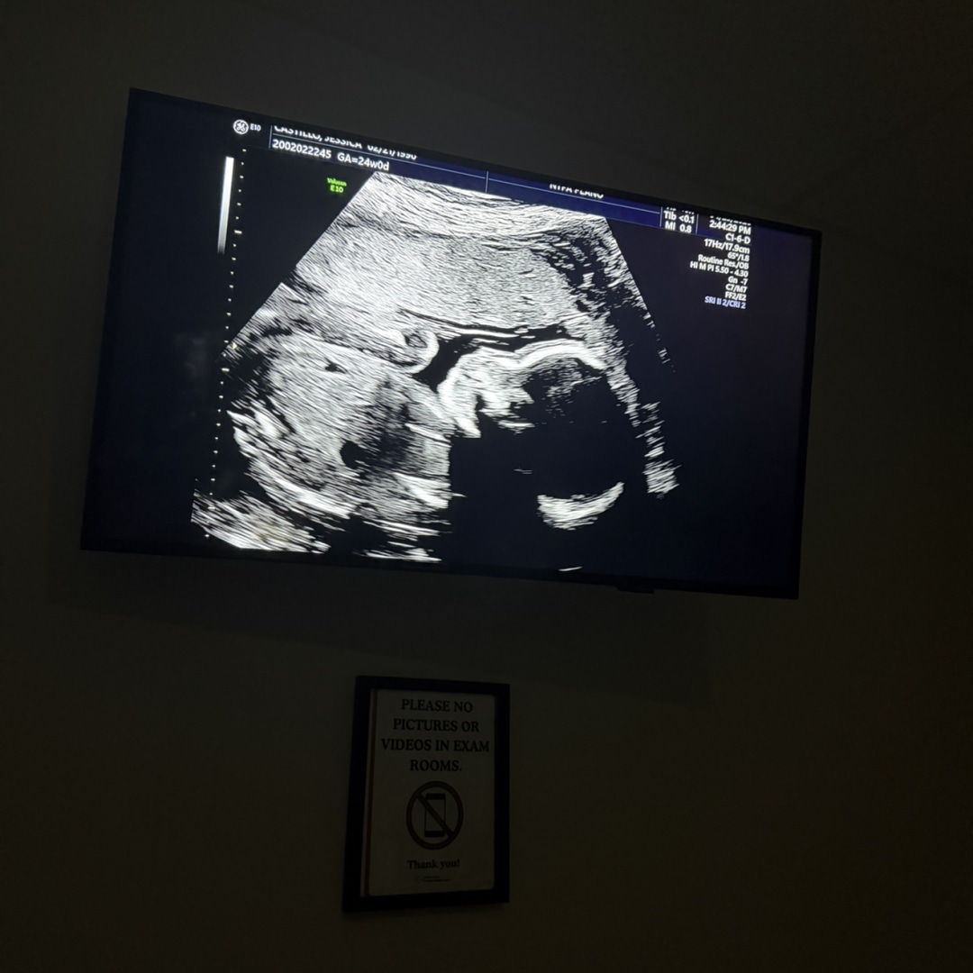 Photo shared by Jessica for their Babylist baby registry.