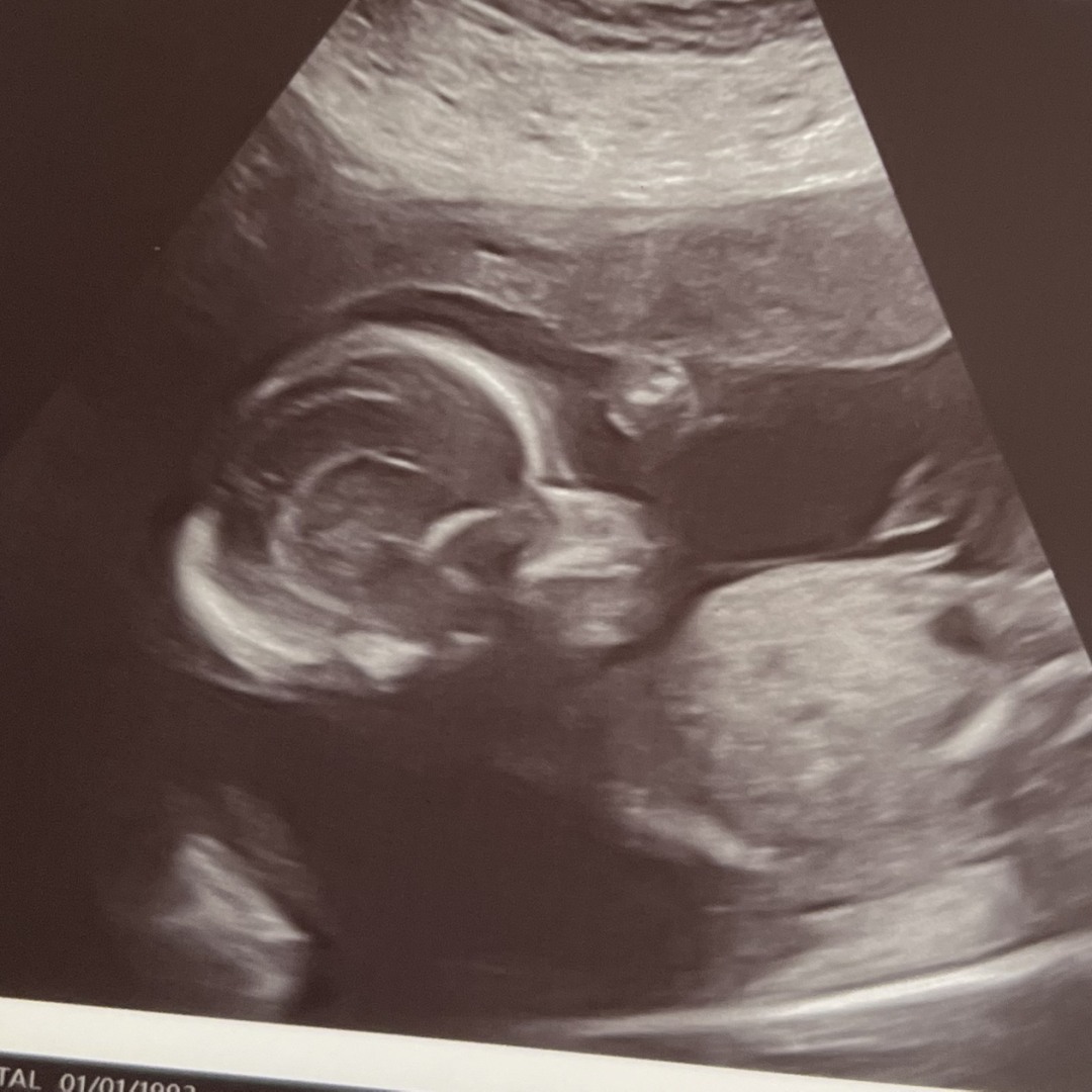 Photo shared by Crystal for their Babylist baby registry.