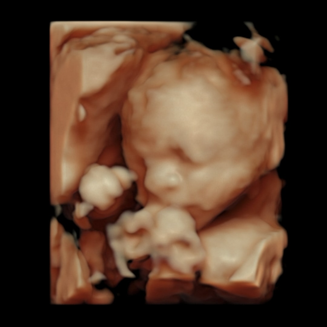 Photo shared by Dawn Ivy for their Babylist baby registry.