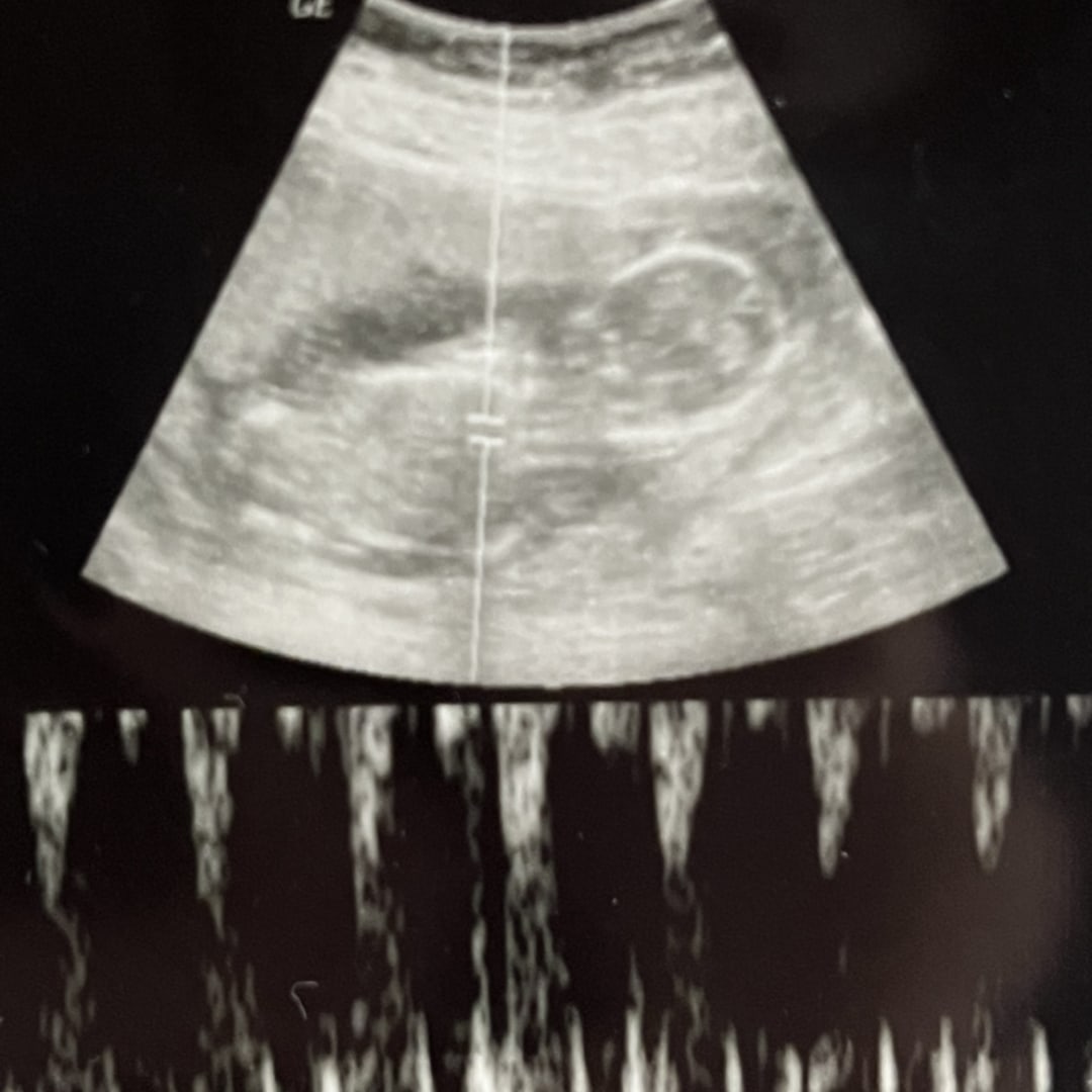 Photo shared by Maggie for their Babylist baby registry.