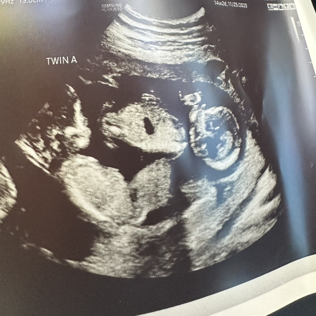 Photo shared by Jasmine for their Babylist baby registry.
