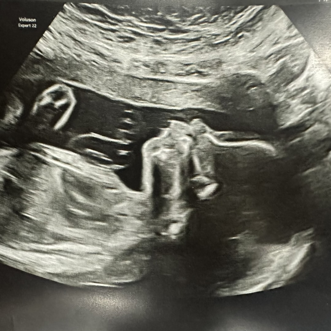 Photo shared by Leticia for their Babylist baby registry.