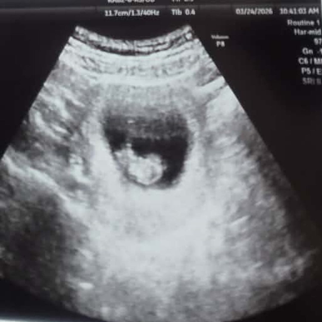 Photo shared by Lena for their Babylist baby registry.