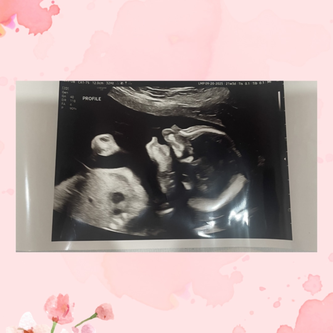 Photo shared by Mirna for their Babylist baby registry.