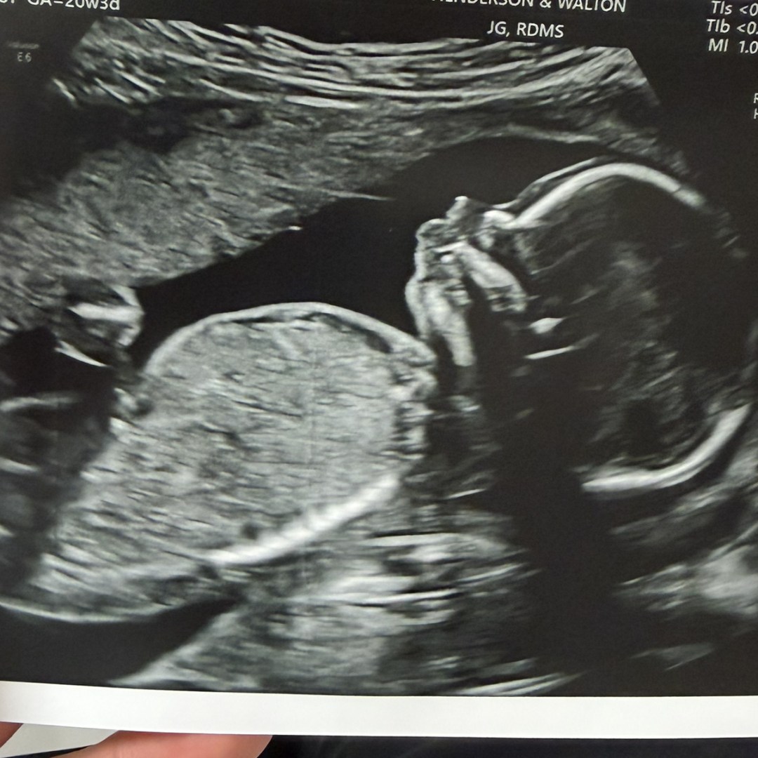 Photo shared by Anna Katherynn for their Babylist baby registry.