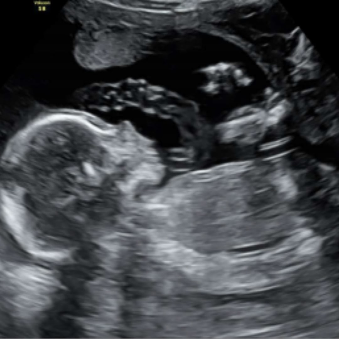 Photo shared by Erika for their Babylist baby registry.