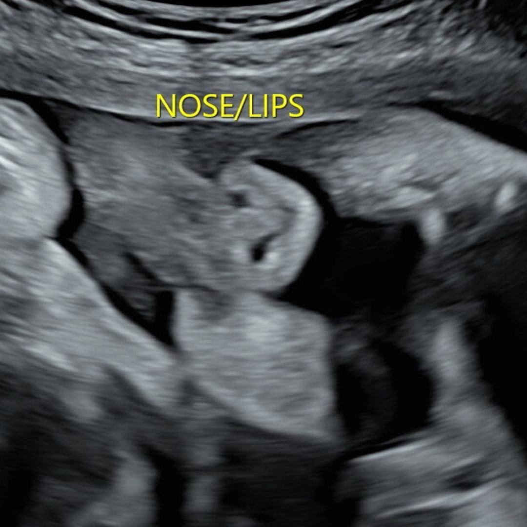 Photo shared by Jessica for their Babylist baby registry.