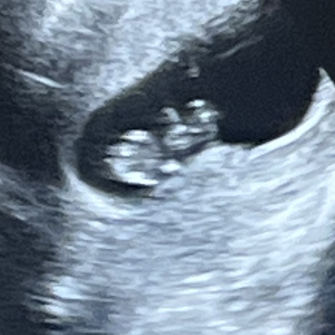 Photo shared by Erika for their Babylist baby registry.