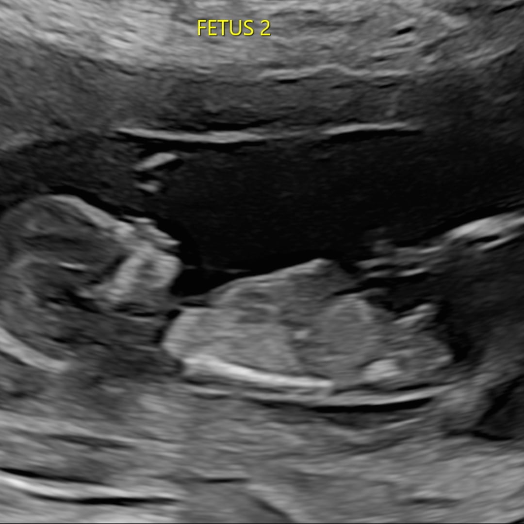 Photo shared by Jimmy for their Babylist baby registry.