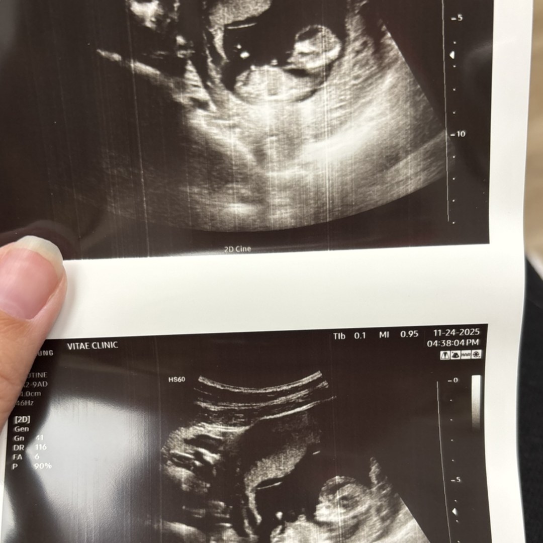 Photo shared by Ashley for their Babylist baby registry.