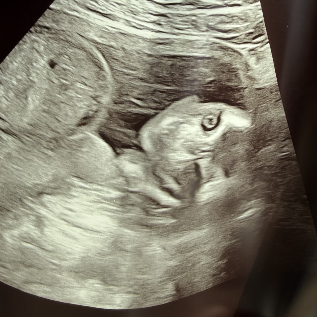 Photo shared by Brooklyn for their Babylist baby registry.