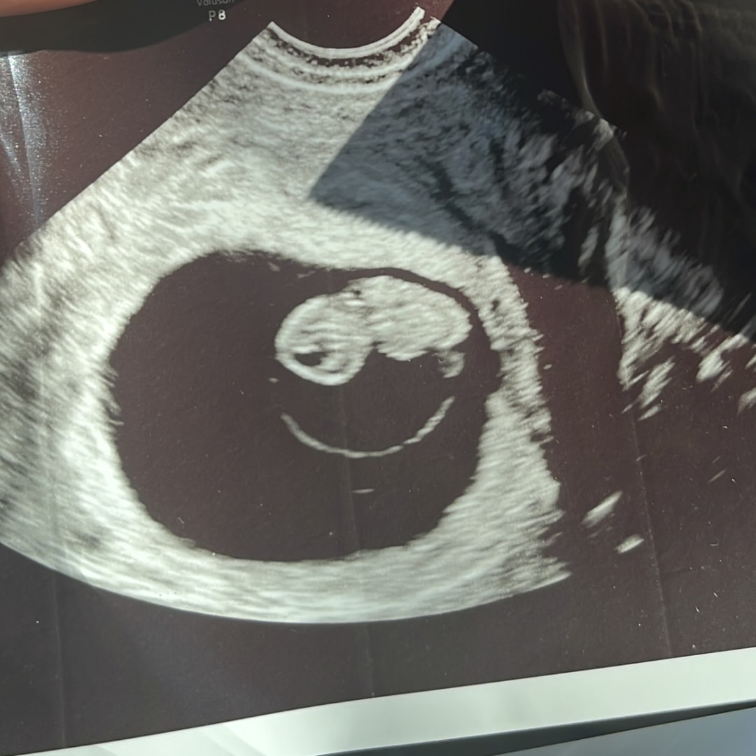 Photo shared by Gabriela for their Babylist baby registry.