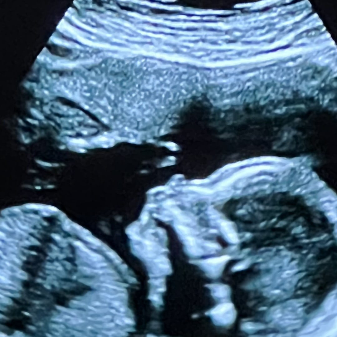 Photo shared by Karen for their Babylist baby registry.