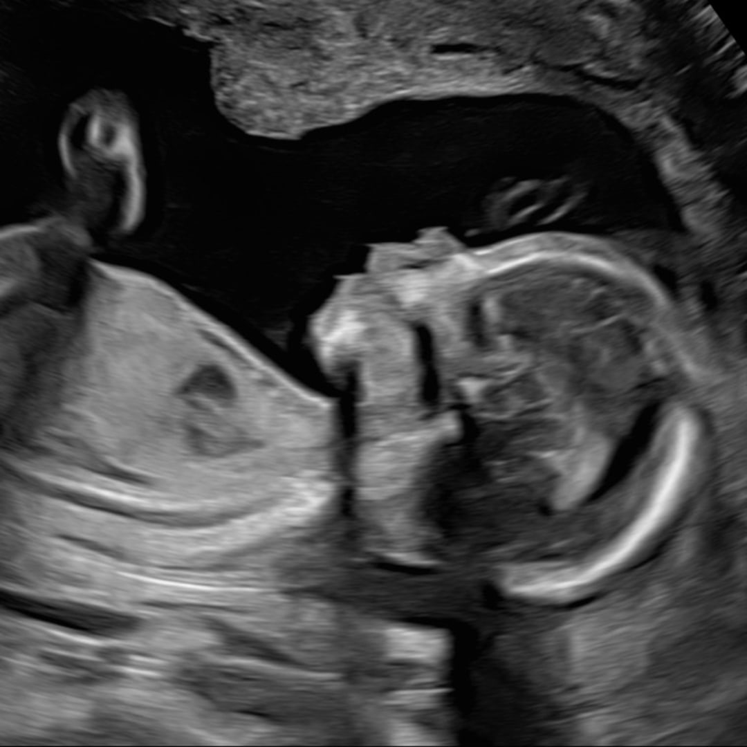 Photo shared by Hasha for their Babylist baby registry.