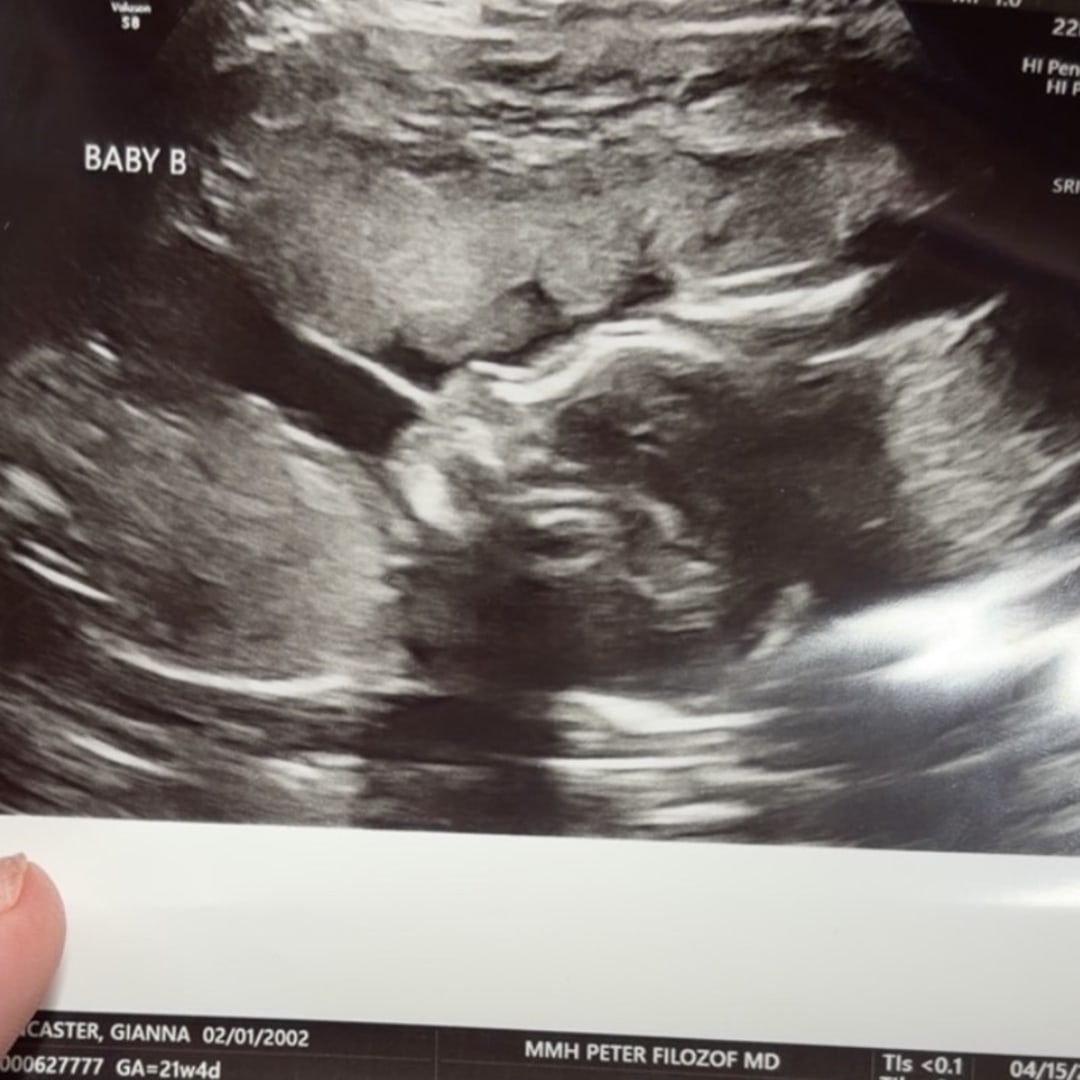 Photo shared by Gianna for their Babylist baby registry.