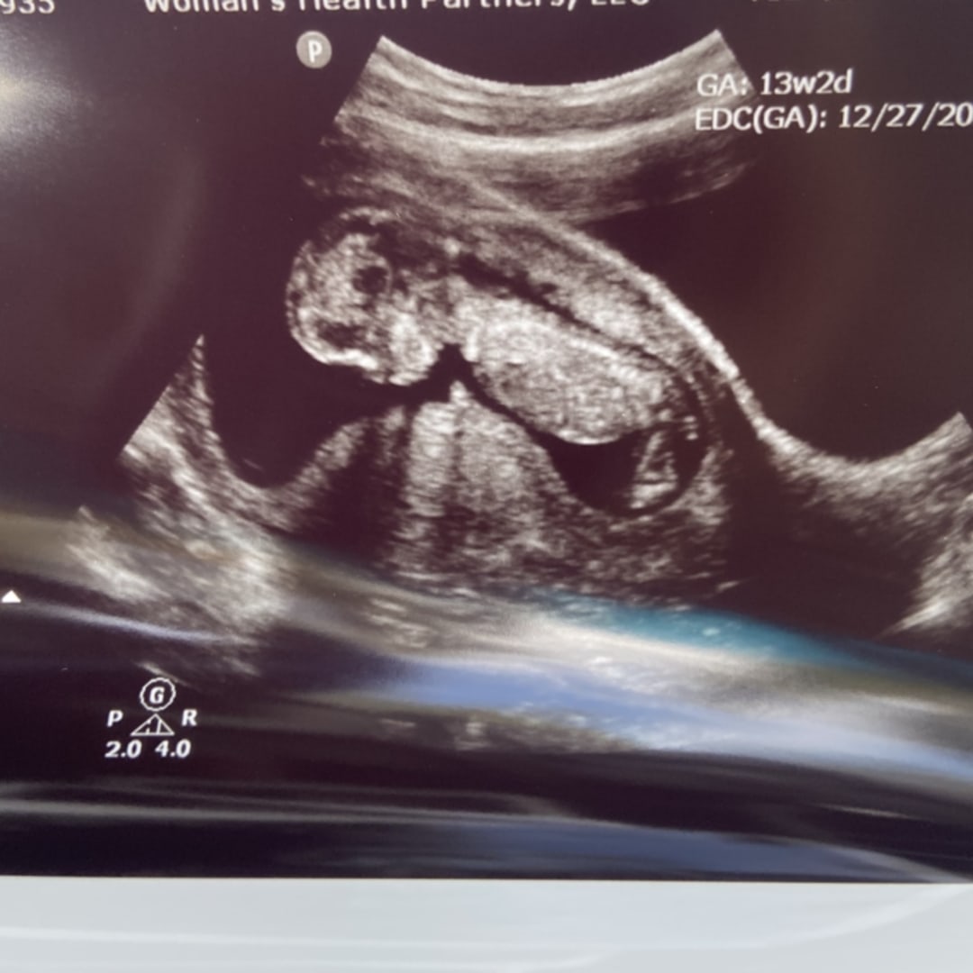 Photo shared by Taylor for their Babylist baby registry.