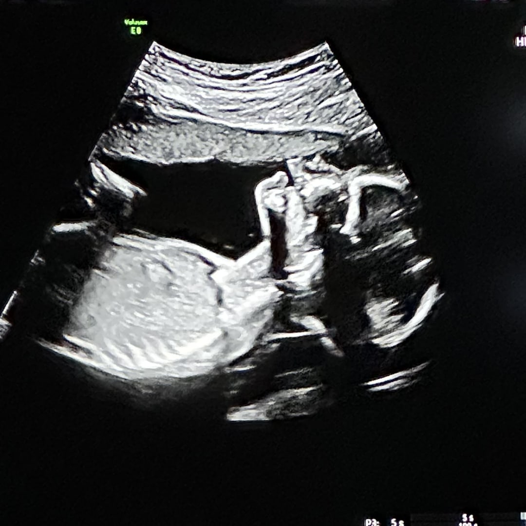 Photo shared by Hailey for their Babylist baby registry.
