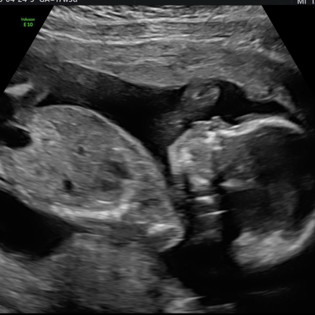 Photo shared by Chynna for their Babylist baby registry.