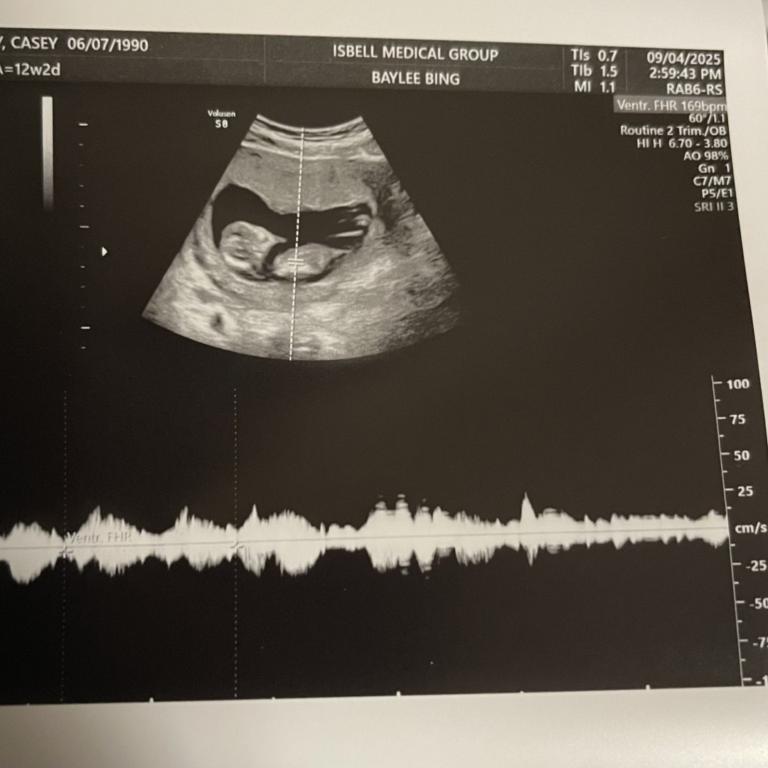 Photo shared by Casey for their Babylist baby registry.