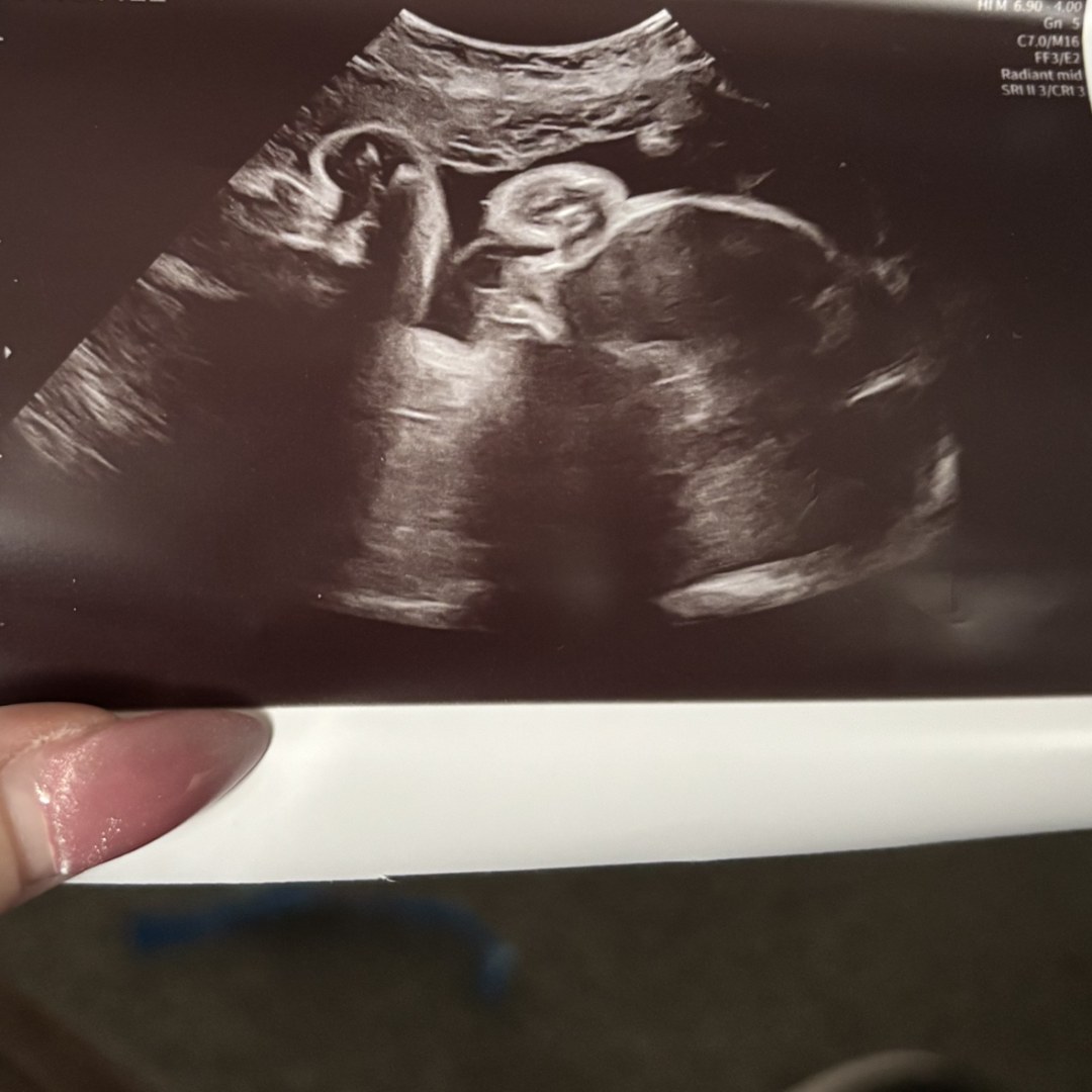 Photo shared by Emily for their Babylist baby registry.