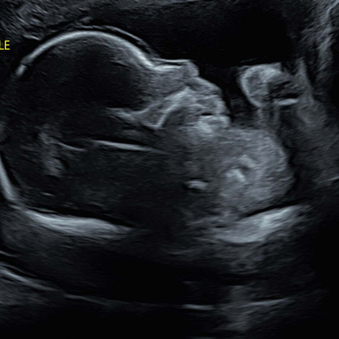 Photo shared by Jessica for their Babylist baby registry.