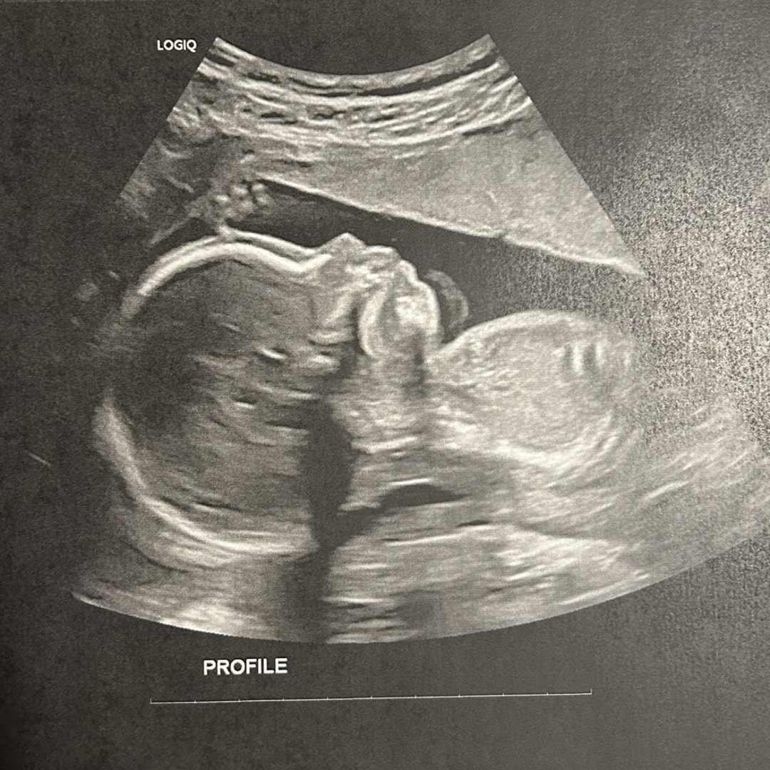 Photo shared by Brylea for their Babylist baby registry.