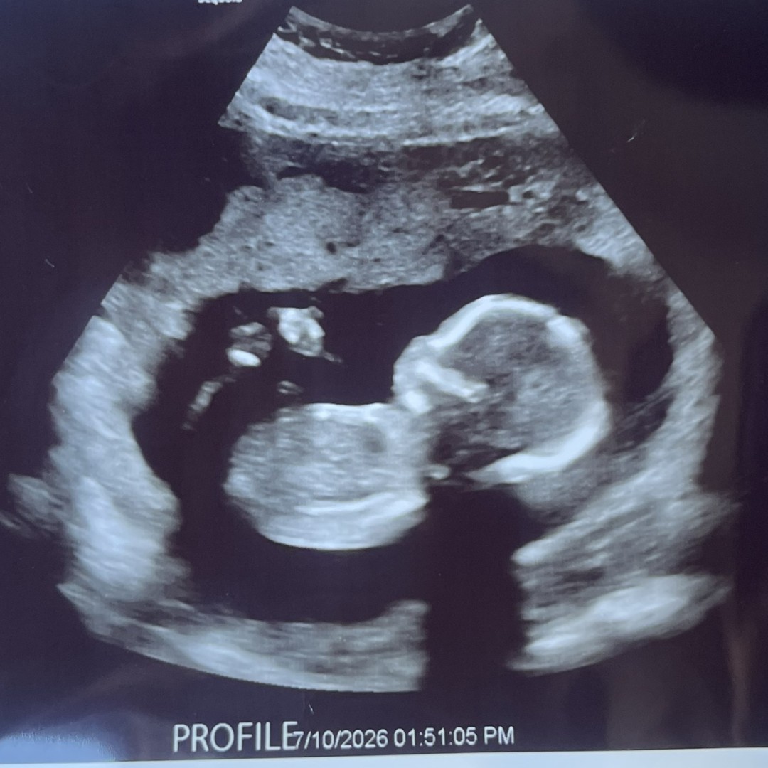 Photo shared by Caroline for their Babylist baby registry.