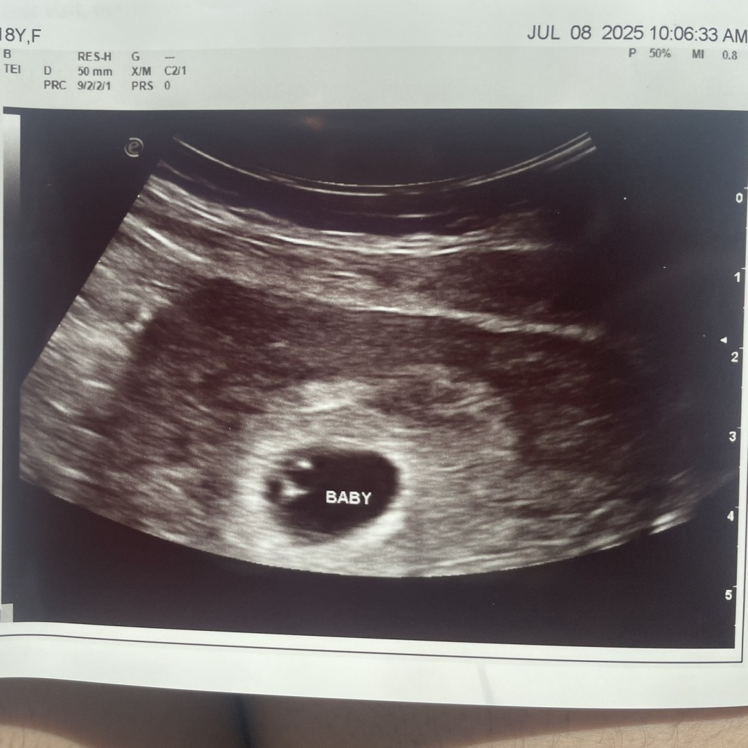 Photo shared by Makayla for their Babylist baby registry.