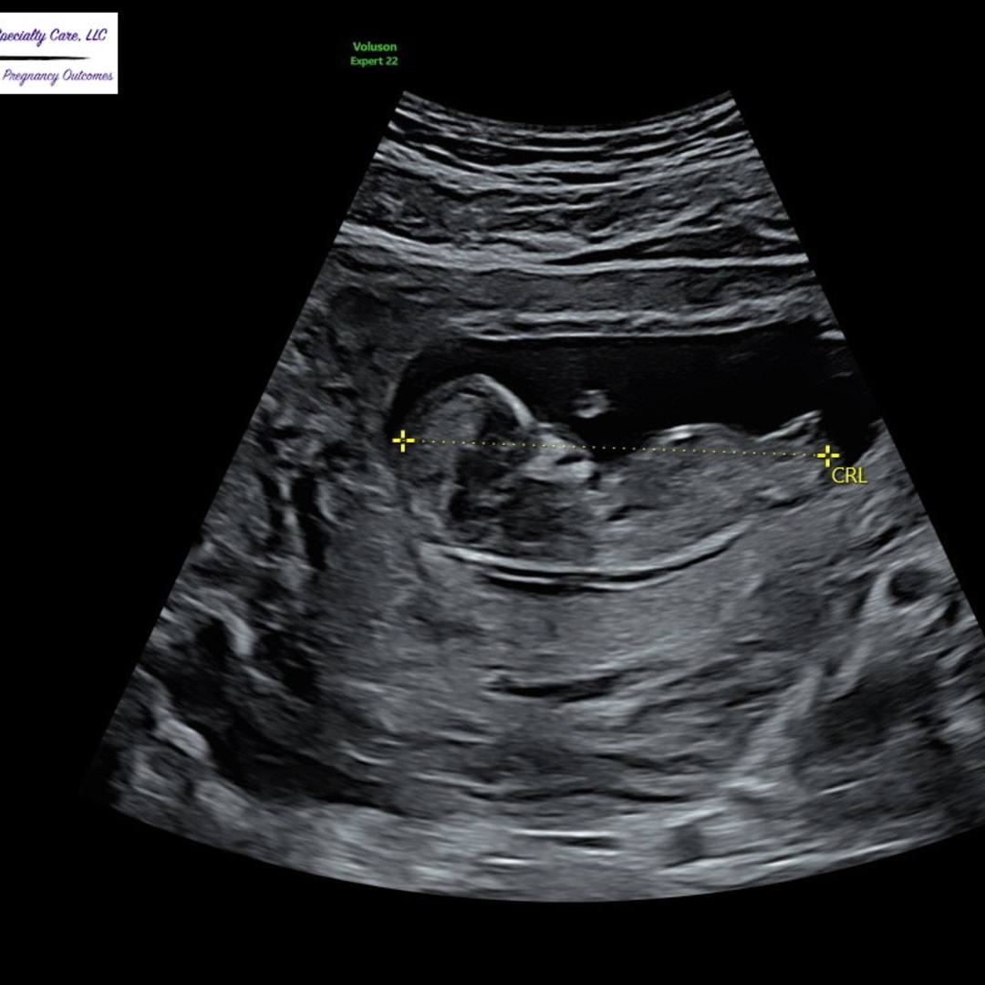 Photo shared by Alby for their Babylist baby registry.
