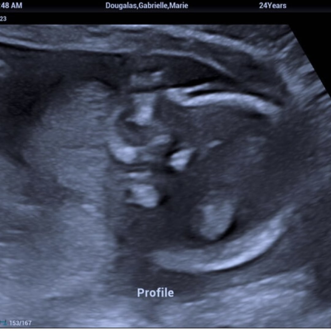 Photo shared by Gabrielle for their Babylist baby registry.