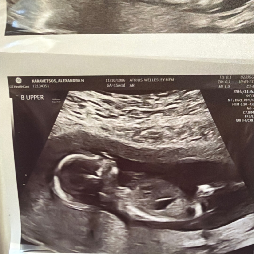 Photo shared by Sunny for their Babylist baby registry.