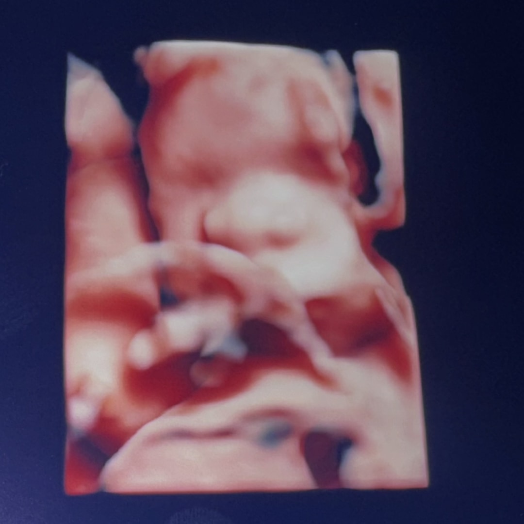 Photo shared by Celeste for their Babylist baby registry.