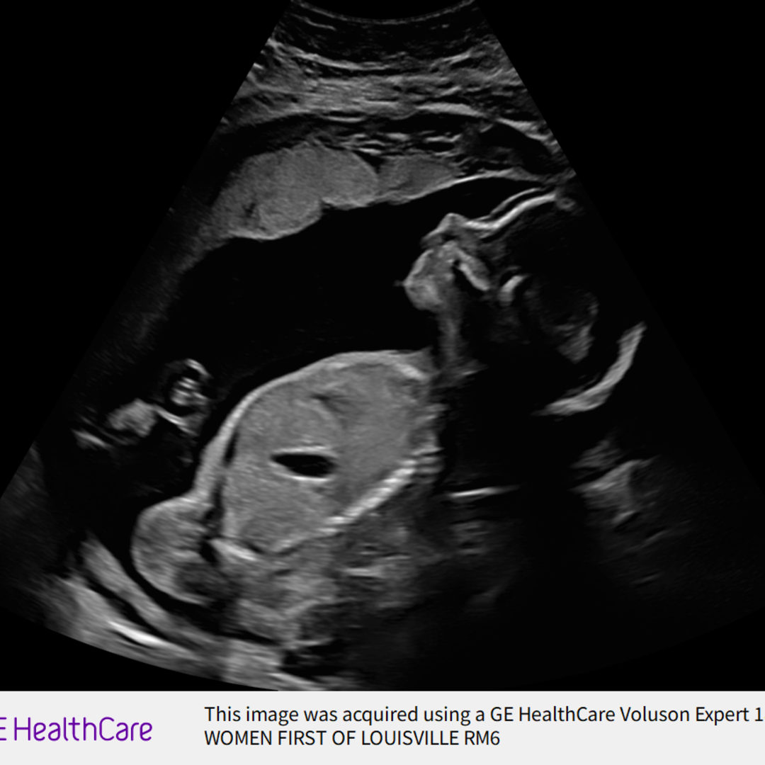 Photo shared by Hanna for their Babylist baby registry.