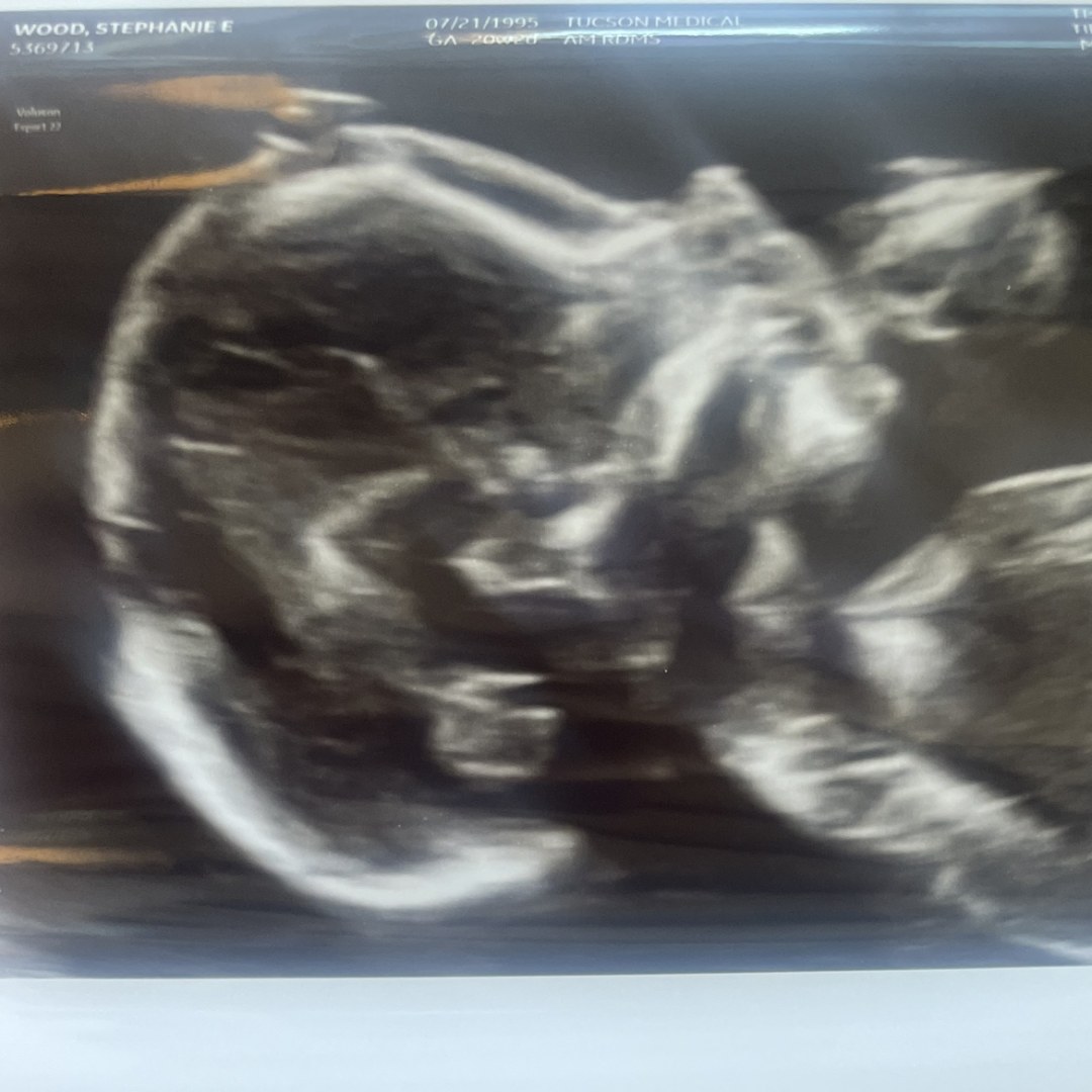 Photo shared by Stephanie for their Babylist baby registry.