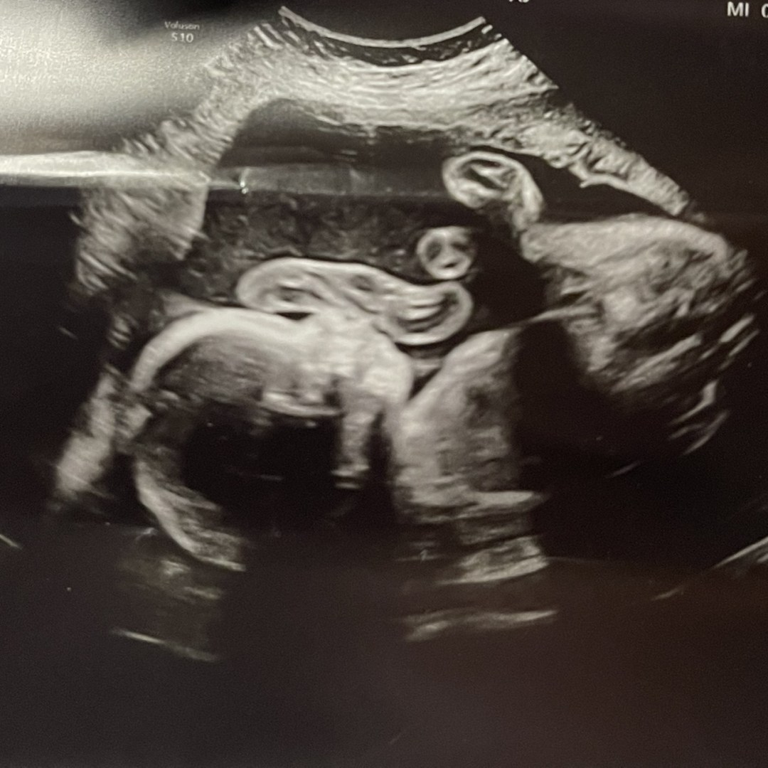 Photo shared by Johnna for their Babylist baby registry.