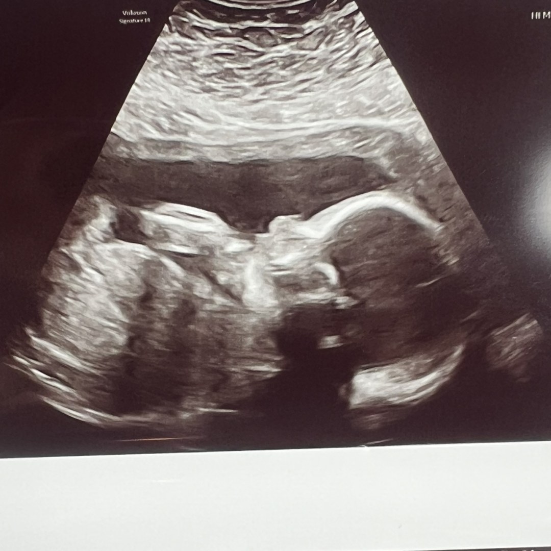 Photo shared by Ashley for their Babylist baby registry.
