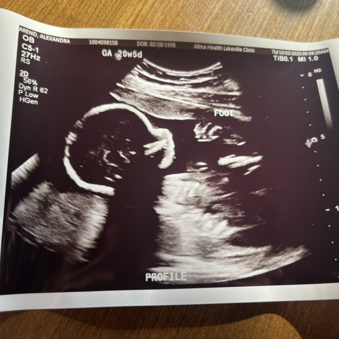 Photo shared by Alex for their Babylist baby registry.