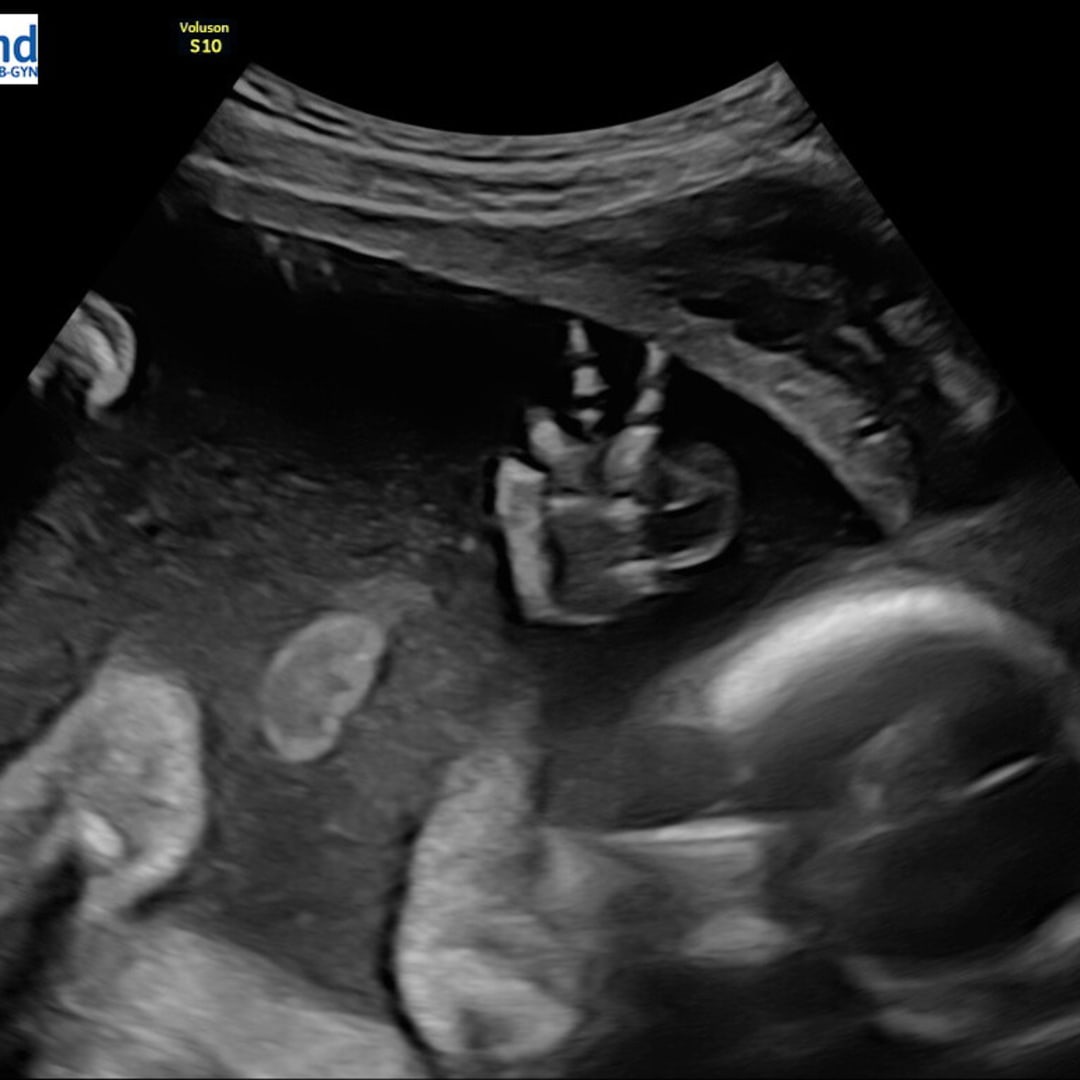 Photo shared by Chelsea for their Babylist baby registry.