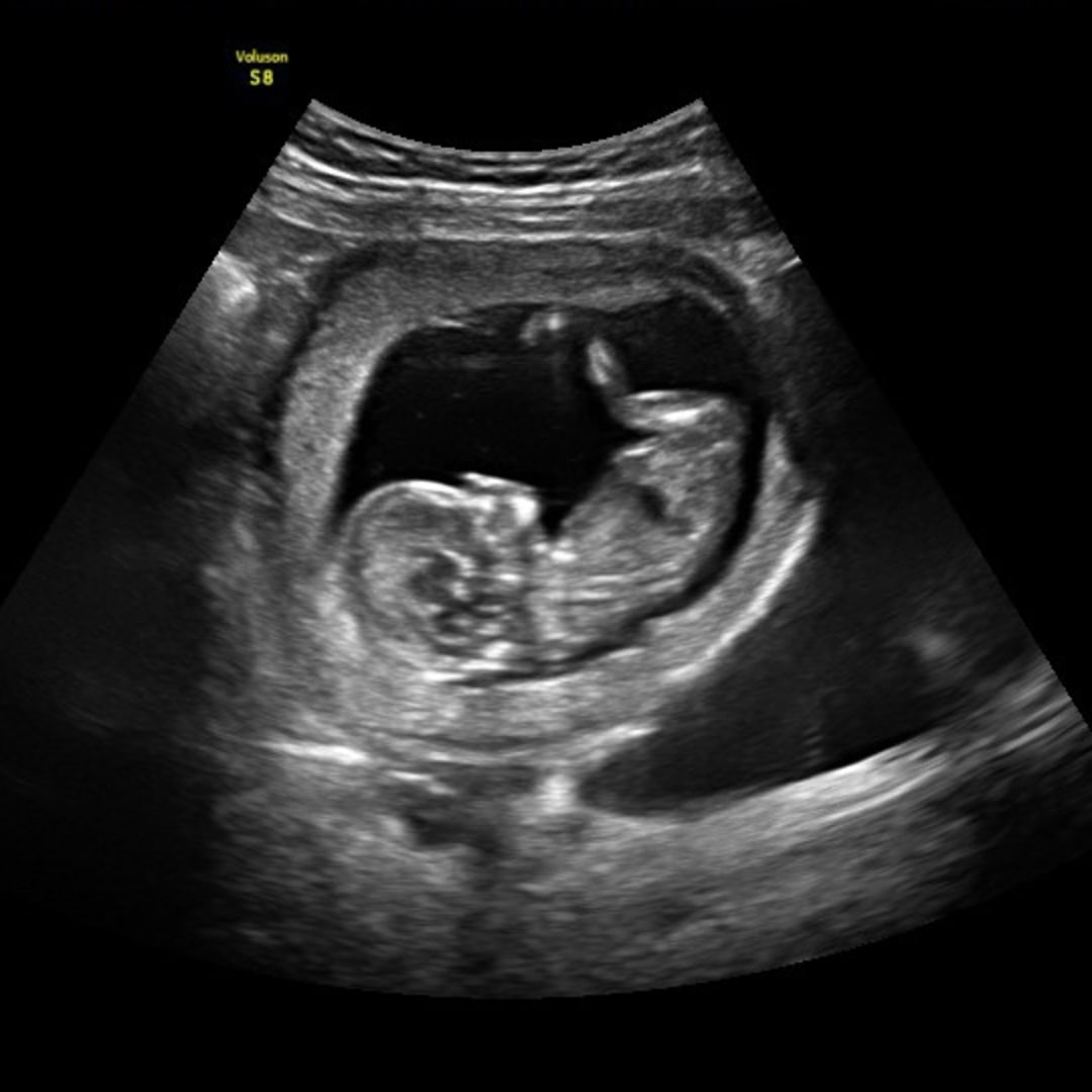 Photo shared by Serena for their Babylist baby registry.